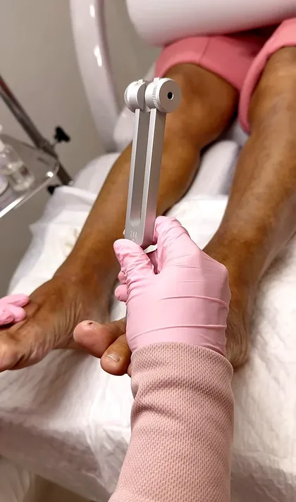 Diapasão utilizado no teste de sensibilidade vibratória do pé