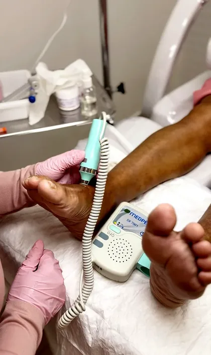 Exame com doppler vascular no pé de um paciente